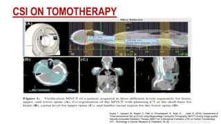 Image Guided Radiotherapy | PPTX