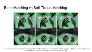 Bone Matching vs Soft Tissue Matching
M. Guckenberger, Image-guided Radiotherapy Based on Kilovoltage Cone-beam Computed Tomography — A Review of Technology and
Clinical Outcome. European Oncology & Haematology. 07, 121 (2011).
 