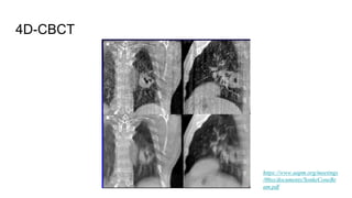 4D-CBCT
https://www.aapm.org/meetings
/06ss/documents/SonkeConeBe
am.pdf
 