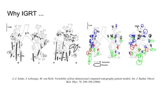 Why IGRT ...
J.-J. Sonke, J. Lebesque, M. van Herk, Variability of four-dimensional computed tomography patient models. Int. J. Radiat. Oncol.
Biol. Phys. 70, 590–598 (2008).
 