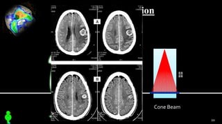 Cone Beam Formation
Cone Beam
20
 