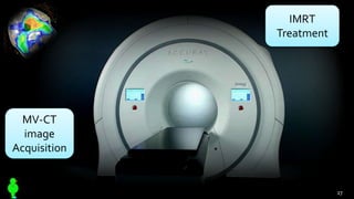 MV-CT
image
Acquisition
IMRT
Treatment
27
 