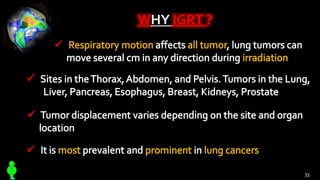 WHY IGRT ?
35
 