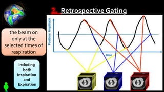 2. Retrospective Gating
44
the beam on
only at the
selected times of
respiration
Including
both
Inspiration
and
Expiration
 