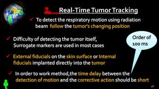 2, Real-TimeTumorTracking
46
 