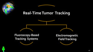 Real-TimeTumor Tracking
47
Electromagnetic
FieldTracking
 