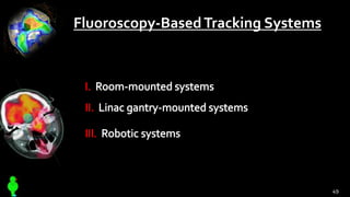 Fluoroscopy-BasedTracking Systems
49
 
