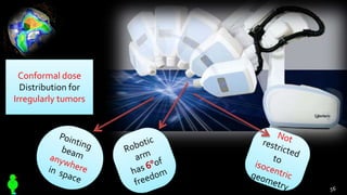Conformal dose
Distribution for
Irregularly tumors
56
 