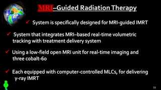 MRI–Guided RadiationTherapy
59
 