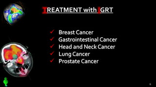 TREATMENT with IGRT





6
 