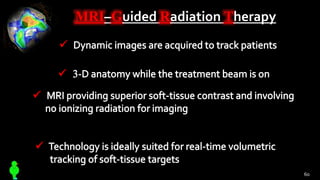 MRI–Guided Radiation Therapy
60
 