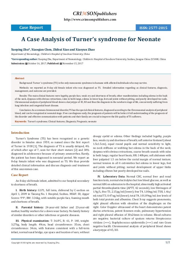 A Case Analysis of Turner’s syndrome for Neonate_Crimson Publishers