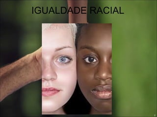 IGUALDADE RACIAL 
