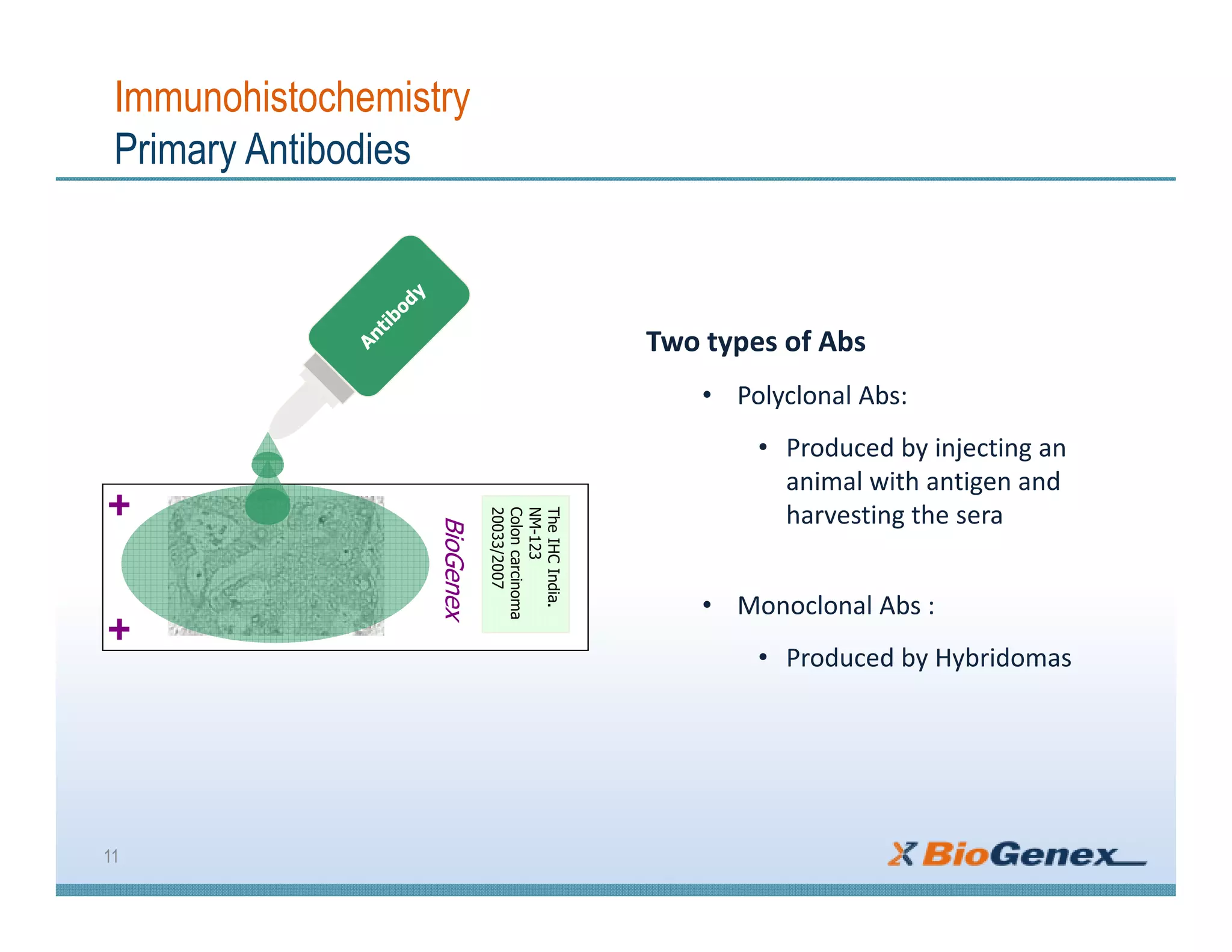 Immunohistochemistry
Primary Antibodies
Two types of Abs
• Polyclonal Abs:
• Produced by injecting an
animal with antigen and
harvesting the sera
• Monoclonal Abs :
• Produced by Hybridomas
11
BioGenex
TheIHCIndia.
NM-123
Coloncarcinoma
20033/2007
 