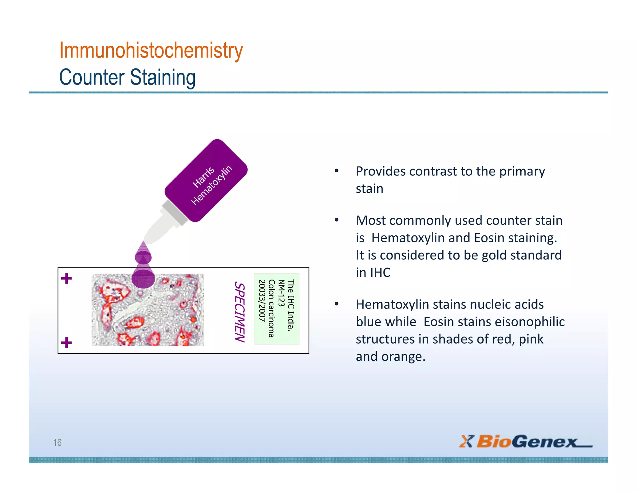 Immunohistochemistry
Counter Staining
• Provides contrast to the primary
stain
• Most commonly used counter stain
is Hematoxylin and Eosin staining.
It is considered to be gold standard
in IHC
• Hematoxylin stains nucleic acids
blue while Eosin stains eisonophilic
structures in shades of red, pink
and orange.
16
SPECIMEN
TheIHCIndia.
NM-123
Coloncarcinoma
20033/2007
 