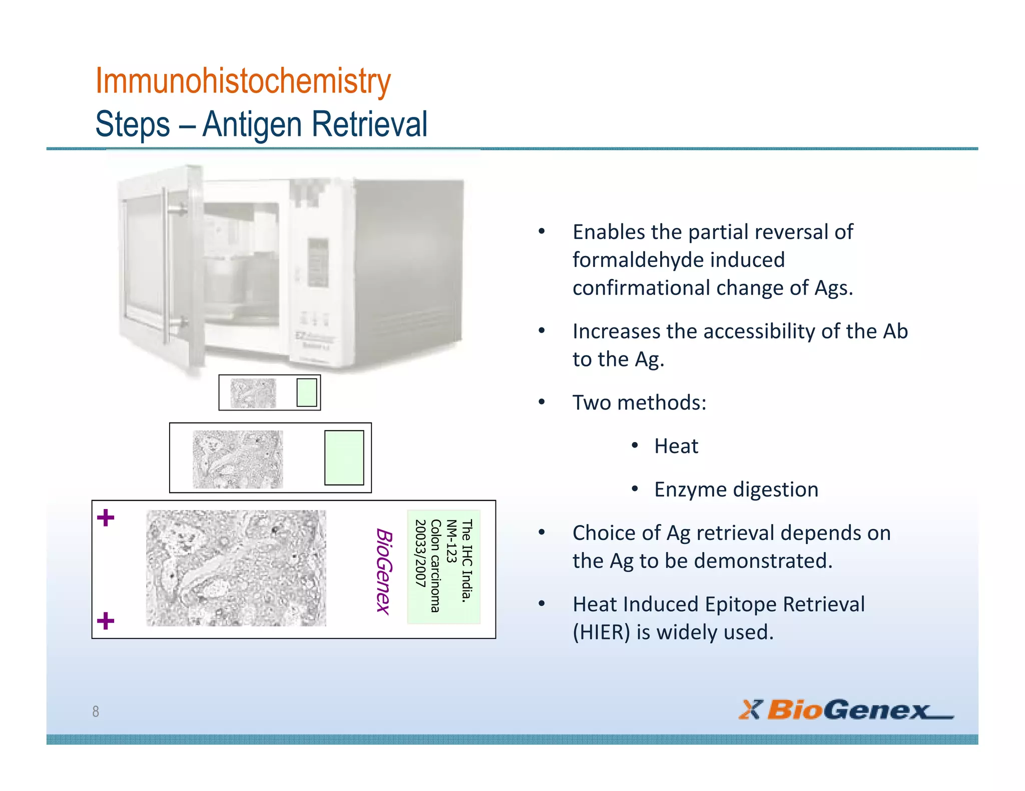 Immunohistochemistry
Steps – Antigen Retrieval
• Enables the partial reversal of
formaldehyde induced
confirmational change of Ags.
• Increases the accessibility of the Ab
to the Ag.
• Two methods:
• Heat
• Enzyme digestion
• Choice of Ag retrieval depends on
the Ag to be demonstrated.
• Heat Induced Epitope Retrieval
(HIER) is widely used.
8
BioGenex
TheIHCIndia.
NM-123
Coloncarcinoma
20033/2007
 