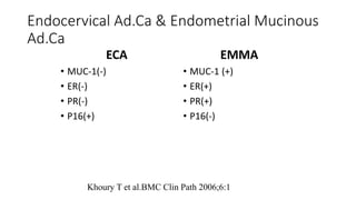Endocervical Ad.Ca & Endometrial Mucinous
Ad.Ca
ECA
• MUC-1(-)
• ER(-)
• PR(-)
• P16(+)
EMMA
• MUC-1 (+)
• ER(+)
• PR(+)
• P16(-)
Khoury T et al.BMC Clin Path 2006;6:1
 
