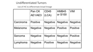 Undifferentiated Tumors
Use of IHC to differentiate broad lineage
Pan CK
AE1/AE3
CD45
(LCA)
HMB45
or S100
VIM
Carcinoma Positive Negative Negative Negative
Melanoma Negative Negative Positive Positive
Sarcoma Negative Negative Negative Positive
Lymphoma Negative Positive Negative Negative
 