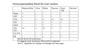 Hepatocellular Colon Biliary Pancreas Ovary
/EM
Sarcoma
Hepar + - - - - -
AFP + - - - - -
CEA - + + +/- +/- -
CK7 - - + + + -
CK20 - + ? ? - -
AE1
AE3
+/- + +/- + + -
CA 19-9 - - - + - -
ER - - - - + -
(Not for Renal Cell Carcinoma).
(?) suggests could be positive 35% to 65% or negative);
and +/- dependent on subtype of histology from that organ.
Immunoperoxidase Panel for Liver Lesions
 