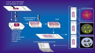 IHC interpretation- and its quality control .pptx