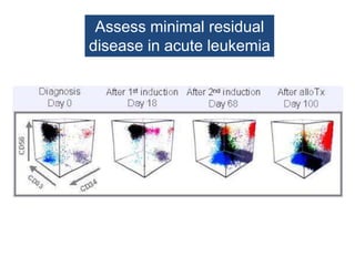 Assess minimal residual
disease in acute leukemia
 