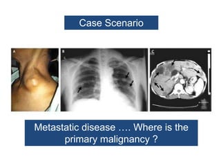 Case Scenario
Metastatic disease …. Where is the
primary malignancy ?
 