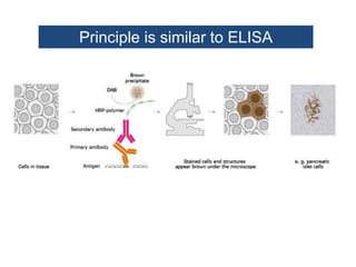 Principle is similar to ELISA
 