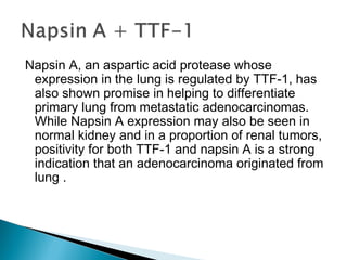 Ihc oncology.ppt1