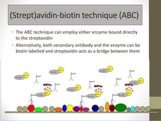 (Strept)avidin-biotin technique (ABC)
• The ABC technique can employ either enzyme bound directly
to the streptavidin
• Alternatively, both secondary antibody and the enzyme can be
biotin labelled and streptavidin acts as a bridge between them
Biotin
Biotin
Biotin
Biotin
Biotin
Biotin
Biotin
Biotin
BiotinA vidin
HRP
A vidin
HRP A vidin
HRP
A vidin
HRP
A vidin
HRP
A vidin
HRP
A vidin
HRP
A vidin
HRP
 