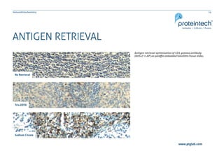 14Immunohistochemistry
www.ptglab.com
ANTIGEN RETRIEVAL
Antigen retrieval optimization of CD3 gamma antibody
(60347-1-AP) on paraffin embedded tonsillitis tissue slides.
Tris-EDTA
Sodium Citrate
No Retrieval
 