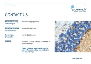 27Immunohistochemistry
www.ptglab.com
CONTACT US
proteintech@ptglab.com
europe@ptglab.com
service@ptglab.com
Available 24 hours via Live Chat and 9–5
(CDT) via phone.
Proteintech Group
Proteintech Europe
Proteintech
Support
US Head Office
United Kingdom
China Office
Please visit us at www.ptglab.com for
more information about our antibodies
and technical tips.
 