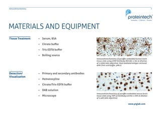 7Immunohistochemistry
www.ptglab.com
MATERIALS AND EQUIPMENT
–– Serum, BSA
–– Citrate buffer
–– Tris-EDTA buffer
–– Boiling source
–– Primary and secondary antibodies
–– Hematoxyline
–– Citrate/Tris-EDTA buffer
–– DAB solution
–– Microscope
Tissue Treatment
Detection/
Visualization
Immunohistochemistry of paraffin-embedded human brain
tissue slide using GFAP Antibody (60190-1-IG) at dilution
of 1:5000 (40x objective). Heat mediated antigen retrieved
with Citric acid buffer, pH6.0.
Immunohistochemistry of paraffin-embedded mouse brain
tissue slide using TDP-43 Antibody (10782-2-AP) at dilution
of 1:400 (40x objective).
 