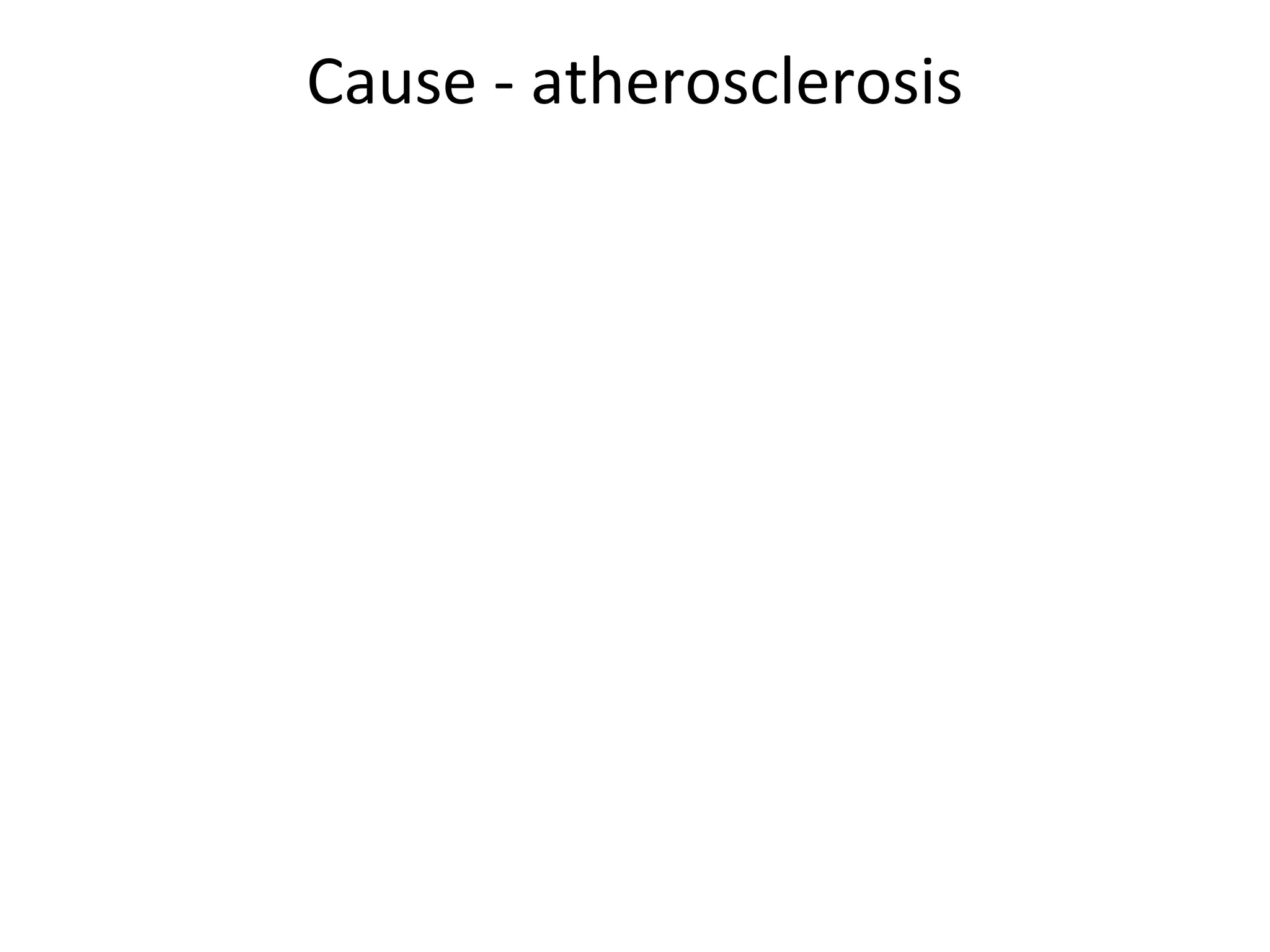 Cause - atherosclerosis 
 