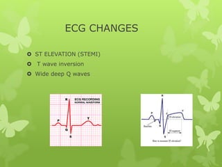 ECG CHANGES
 ST ELEVATION (STEMI)
 T wave inversion
 Wide deep Q waves
 