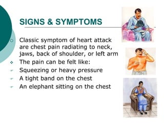 SIGNS & SYMPTOMS
 Classic symptom of heart attack
are chest pain radiating to neck,
jaws, back of shoulder, or left arm
 The pain can be felt like:
 Squeezing or heavy pressure
 A tight band on the chest
 An elephant sitting on the chest
 