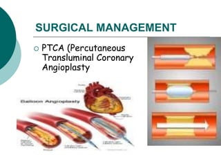 SURGICAL MANAGEMENT
 PTCA (Percutaneous
Transluminal Coronary
Angioplasty
 