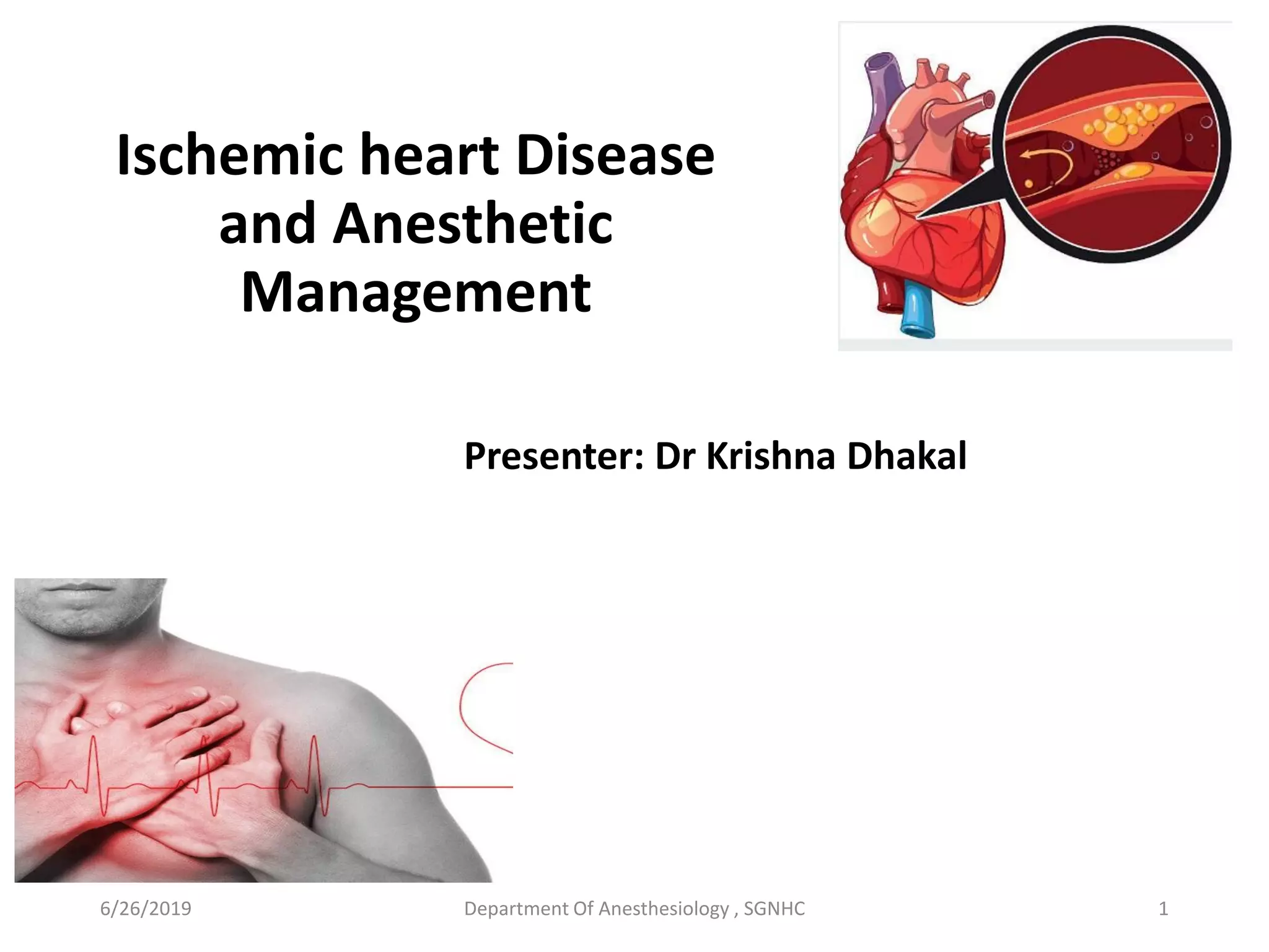 Ischemic heart disease and anesthetic management | PDF