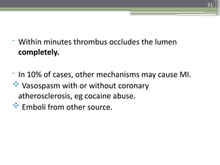 31
- Within minutes thrombus occludes the lumen
completely.
- In 10% of cases, other mechanisms may cause MI.
 Vasospasm with or without coronary
atherosclerosis, eg cocaine abuse.
 Emboli from other source.
 