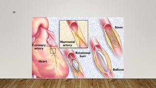 Ischemia visual data 8