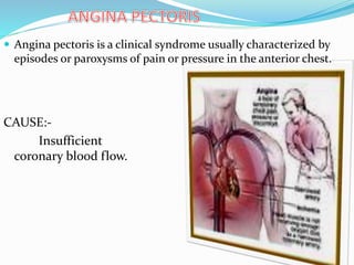 CAUSE:-
Insufficient
coronary blood flow.
 Angina pectoris is a clinical syndrome usually characterized by
episodes or paroxysms of pain or pressure in the anterior chest.
 