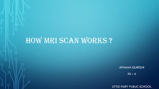 HOW MRI SCAN WORKS ?
AFNAAN QURESHI
XII – A
LITTLE FAIRY PUBLIC SCHOOL
 