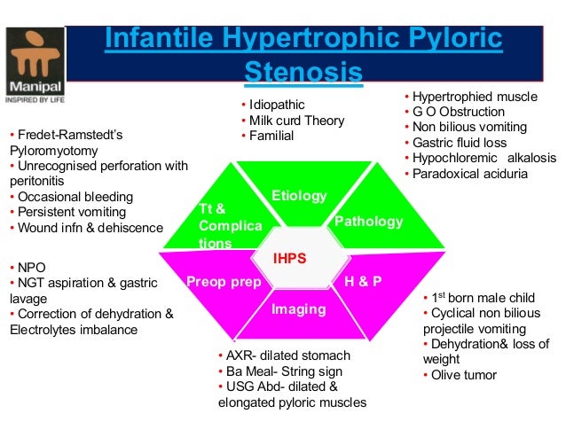 infantile-hypertrophic-pyloric-stenosis-an-overview