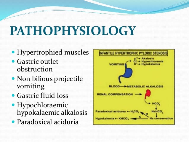 Infantile Hypertrophic Pyloric Stenosis