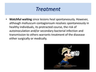 Treatment
• Watchful waiting since lesions heal spontaneously. However,
although molluscum contagionsum resolves spontaneously in
healthy individuals, its protracted course, the risk of
autoinoculation and/or secondary bacterial infection and
transmission to others warrants treatment of the diasease
either surgically or medically.
 