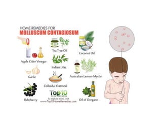 molluscum contagiosum