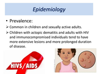 Epidemiology
• Prevalence:
 Common in children and sexually active adults.
 Children with actopic dematitis and adults with HIV
and immunocompromised individuals tend to have
more extensive lesions and more prolonged duration
of disease.
 