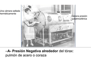 –A- Presión Negativa alrededor del tórax:
pulmón de acero o coraza
Genera presión
subatmosférica
Una cámara sellada
herméticamente
 