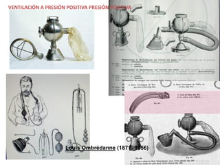 Louis Ombrédanne (1871- 1956)
VENTILACIÓN A PRESIÓN POSITIVA PRESIÓN POSITIVA
 