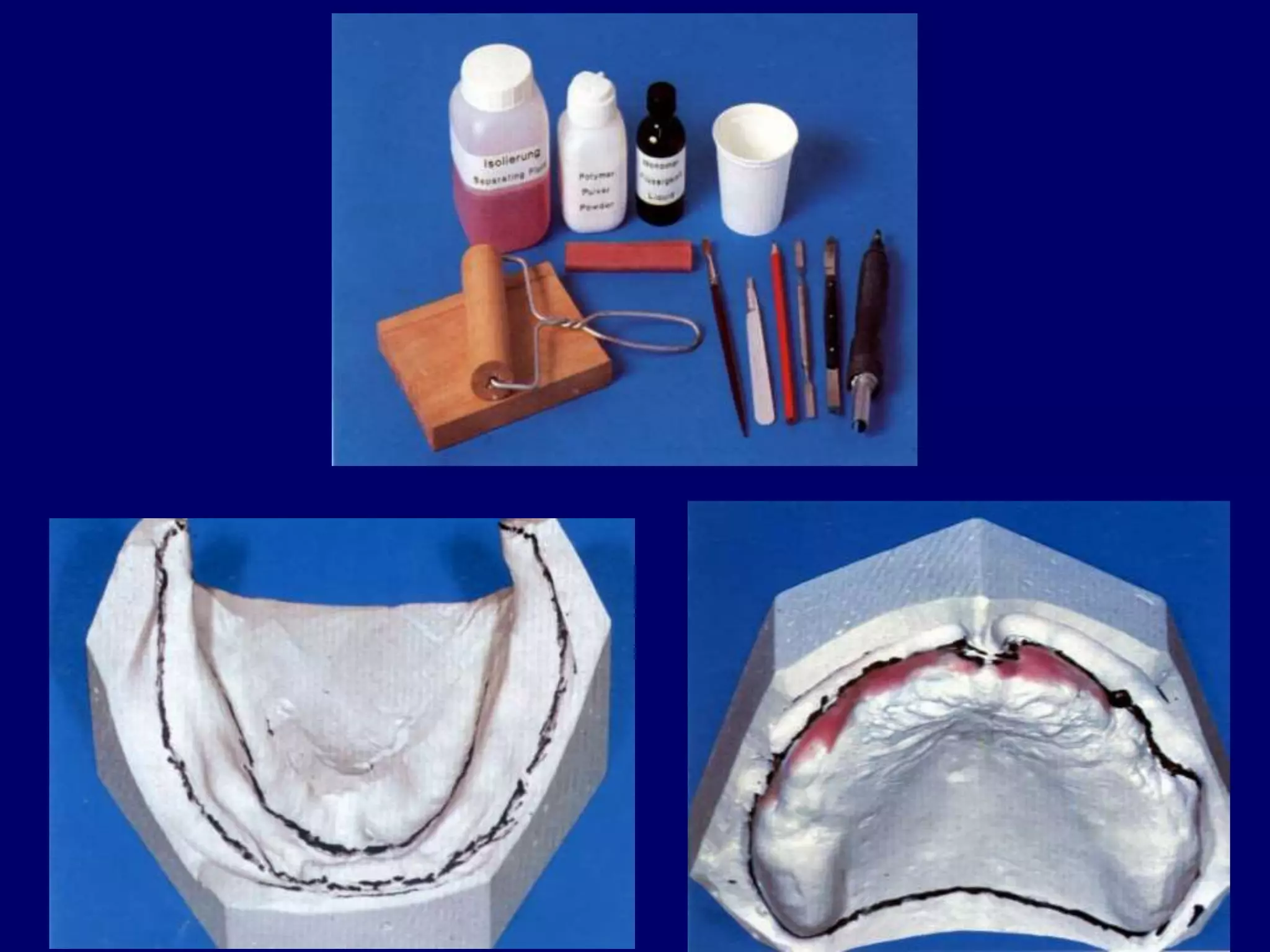 II. impression making for complete denture | PPT