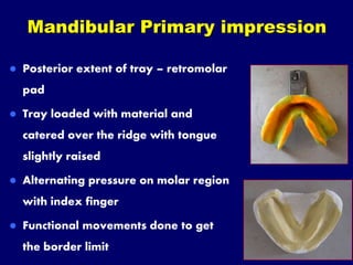 II. impression making for complete denture | PPT